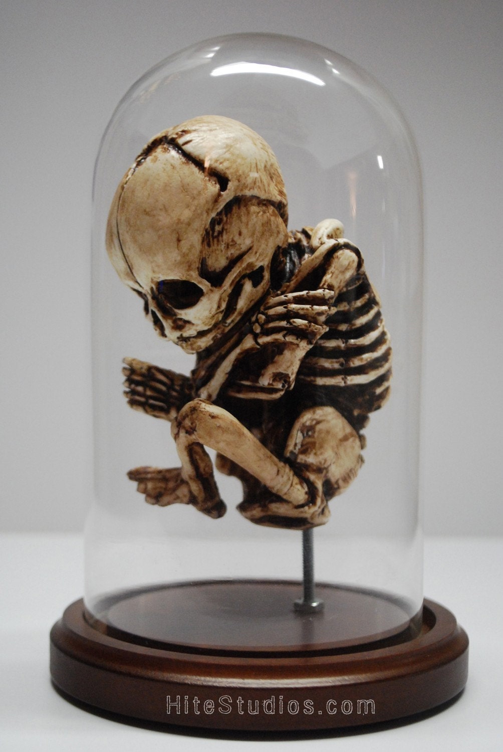 Skeletal Fetus