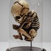 Skeletal Fetus