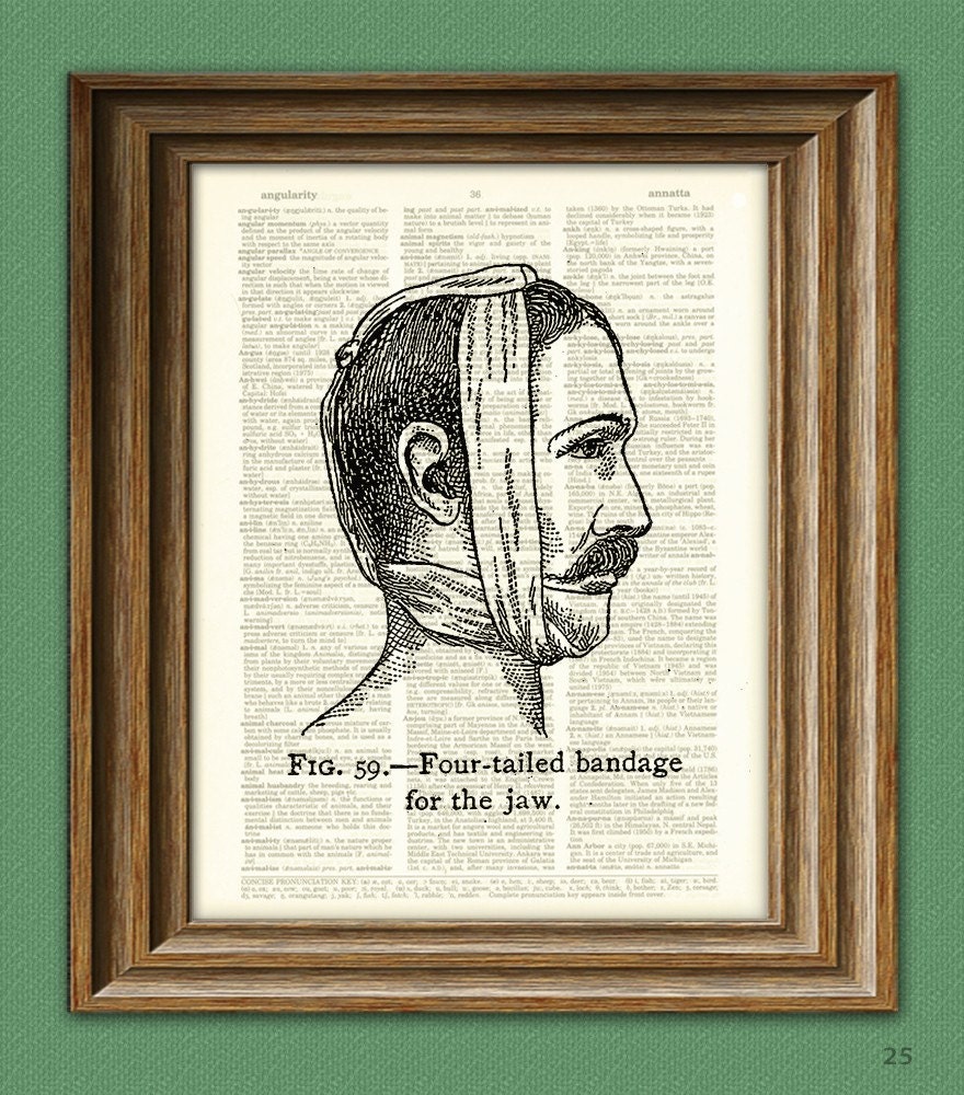 OUCH Broken Jaw Medical Illustration cool upcycled dictionary page book art print