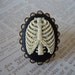 SKELE-GRO RING - Wizarding Inspired Bone Regenerator Adjustable Ring Potion Lost Bones Broken Arm Antiqued Brass Filigree