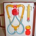 1977 Fisher Price Medical Kit