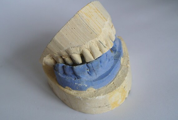 Vintage cast of real teeth featured image