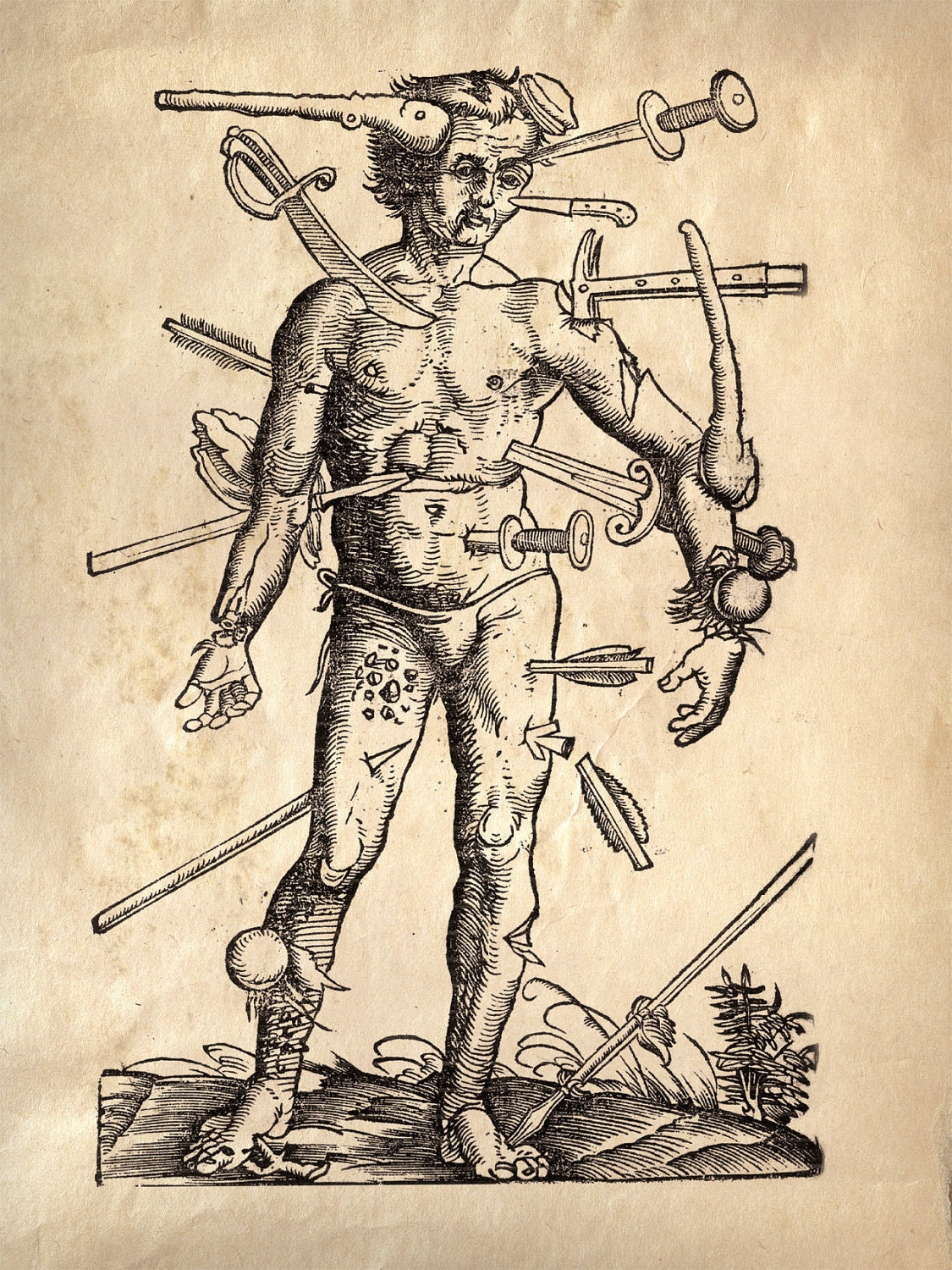 18x24 Vintage Anatomy. Wounded Man. Antique Weapons. Swords. Knives -029