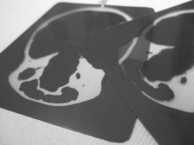 Skeleton X Ray Upcycled Earrings