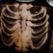 Psycho Ribcage Grunge Top