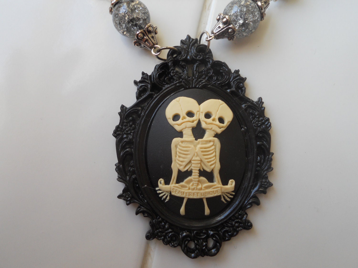 Conjoined Twins Skeleton