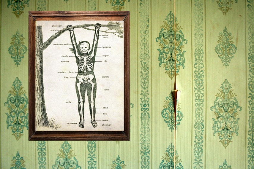 Vintage Medical Illustration "Skeleton Swing" Antique Anatomical Diagram - Whimsical Children's Book Nursery Art