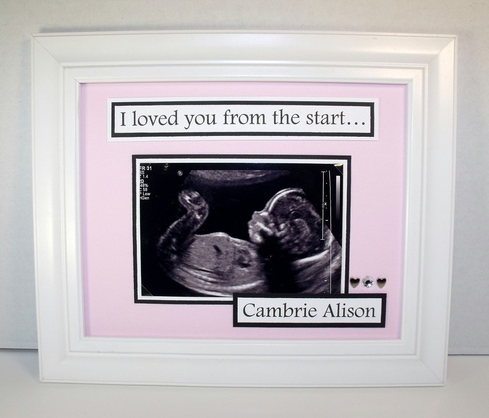 Ultrasound Art - I Loved You From The Start - Personalized Baby Photo Keepsake - 8x10 Deluxe Frame Included - Any Color - Any Message