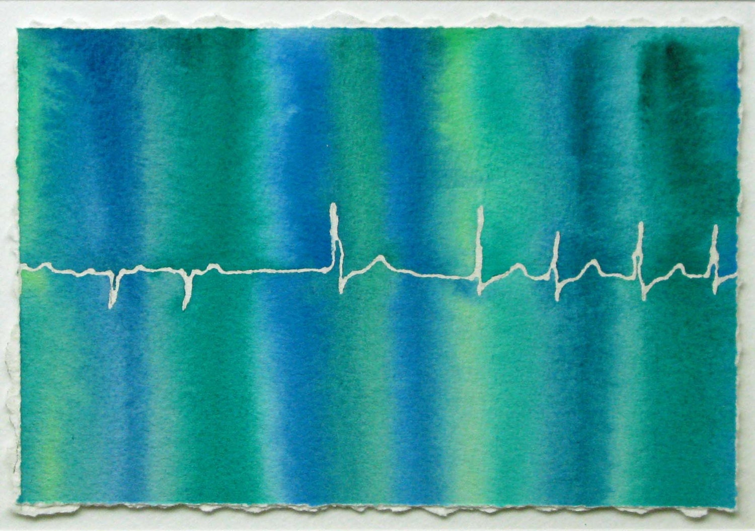 Blue-Green Atrial Fibrillation - original watercolor ekg painting