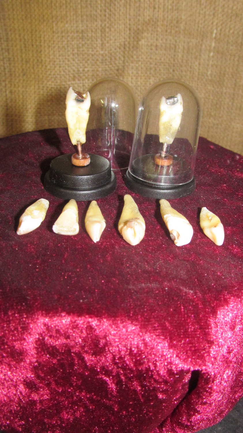 Human tooth keepsake in display dome for your curio cabinet