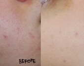High Coverage Mineral Foundation Samples - With Honey, Lemongrass, and Jojoba - 3 Gram Jar