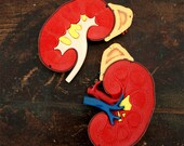 Vintage Medical Model - Kidney
