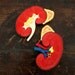 Vintage Medical Model - Kidney